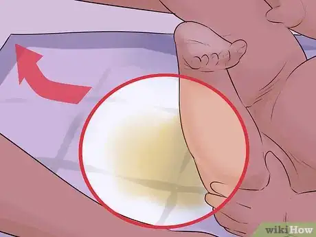 Image titled Help a Male Child Provide a Urine Sample Step 32