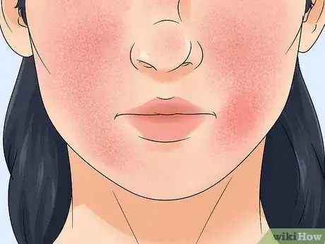 Image titled Is It Safe to Use Glycolic Acid Every Day Step 11