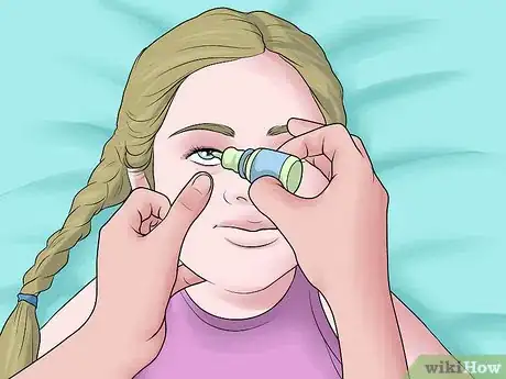 Image titled Easily Give Eyedrops to a Baby or Child Step 19