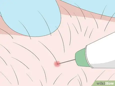 Image titled Shave Your Genitals (Male) Step 14