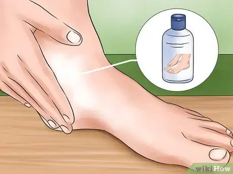 Image titled Shave Dead Skin off Feet Step 13