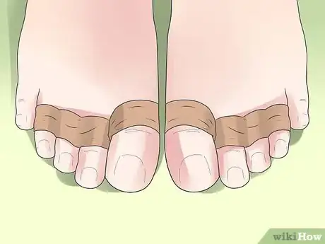 Image titled Tape Your Toes for Beam Step 3