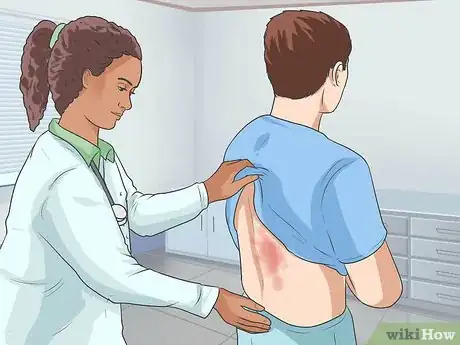 Image titled Diagnose Psoriasis Step 8