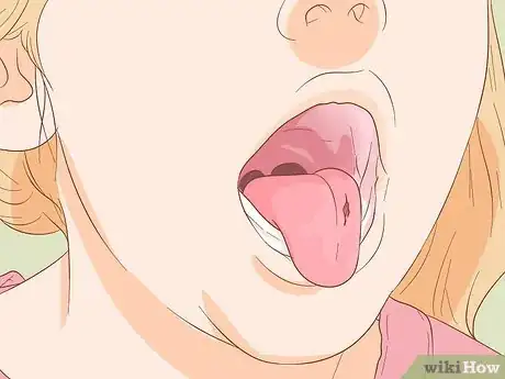 Image titled Stop Tongue Bleeding Step 4