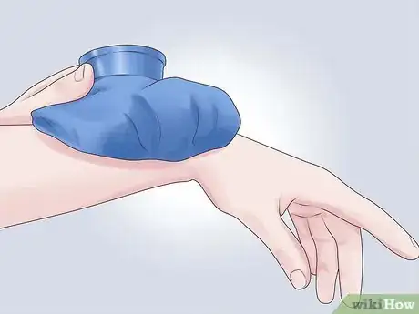 Image titled Prevent Carpal Tunnel Syndrome Step 14