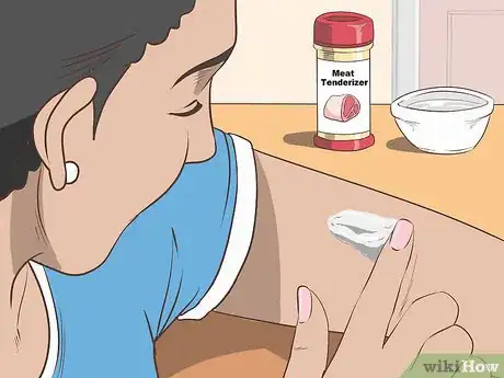 Image titled Stop Mosquito Bites from Itching Step 3