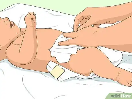 Image titled Relieve Diaper Rash Fast Step 15