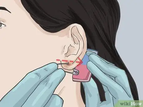 Image titled Pierce Your Ear with a Safety Pin Step 8