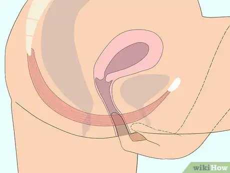 Image titled Do Kegel Exercises Step 2