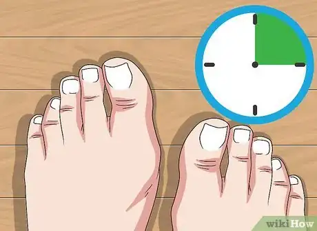 Image titled Do a Self Pedicure Step 17