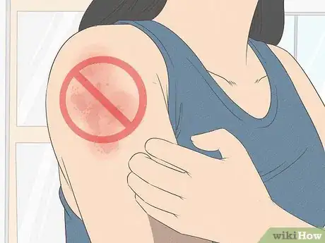 Image titled Prevent Heat Rash Step 14