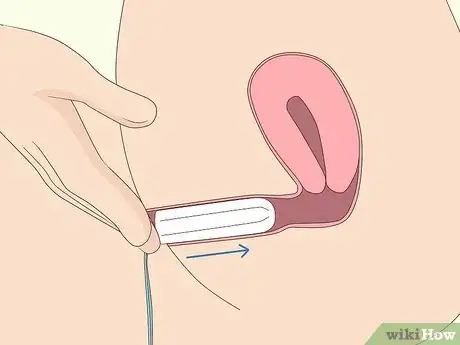 Image titled Insert a Tampon Without Applicator Step 7