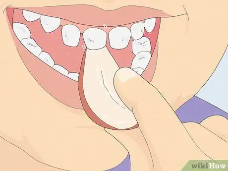 Image titled Pull a Loose Tooth at Home Step 2