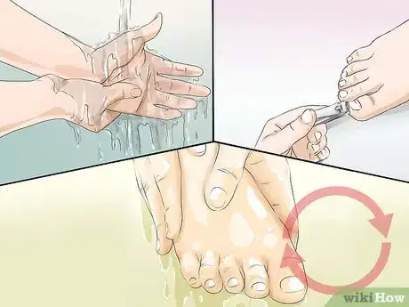 Image titled Prevent the Spread of Fungal Infections Step 14