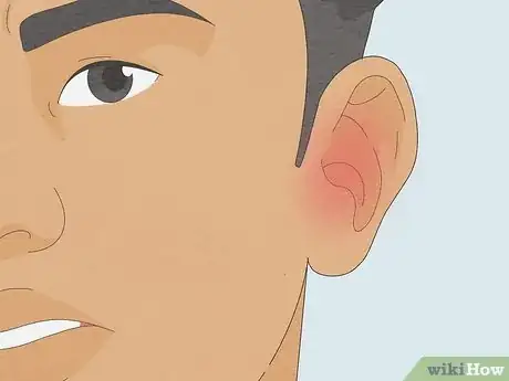 Image titled Remove a Bug from Your Ear Step 6