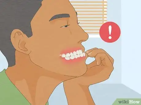 Image titled Straighten Your Teeth Without Braces Step 2