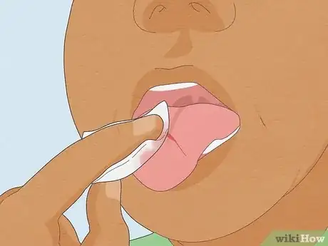 Image titled Heal a Cut on Your Tongue Step 3