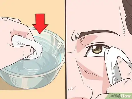 Image titled Remove Something from Your Eye Step 5