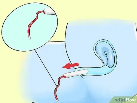 Image titled Remove a Tampon Step 5