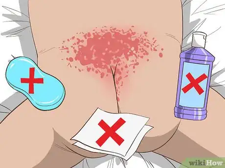 Image titled Identify and Treat Different Types of Diaper Rash Step 5