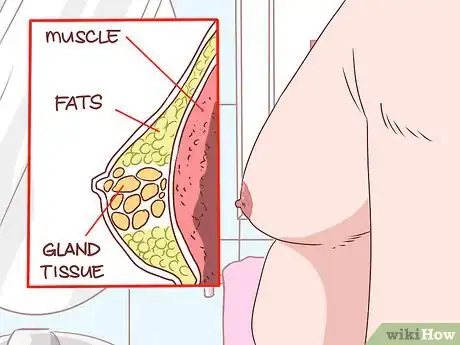 Image titled Recognize Cirrhosis Step 13