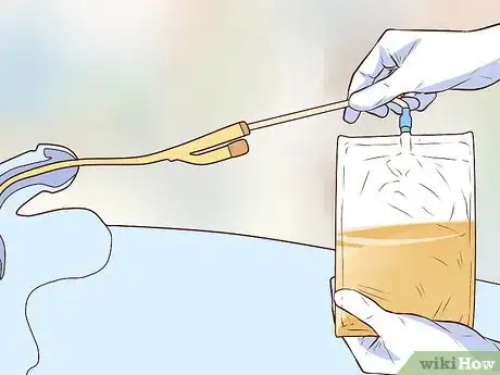 Image titled Insert a Catheter Step 11