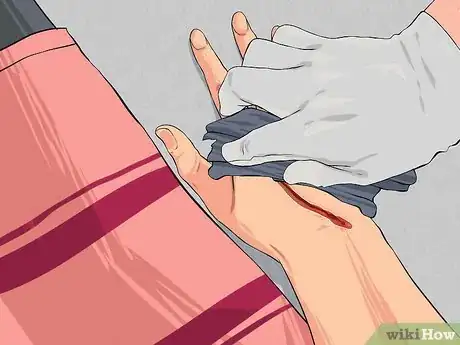 Image titled Apply First Aid without Bandages Step 11