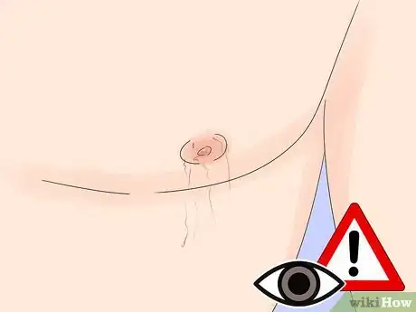 Image titled Lighten Nipples Step 8