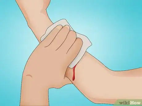 Image titled Make a Quick Disinfectant for Minor Cuts and Abrasions Step 1