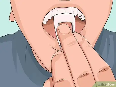 Image titled Make Vampire Fangs Step 12