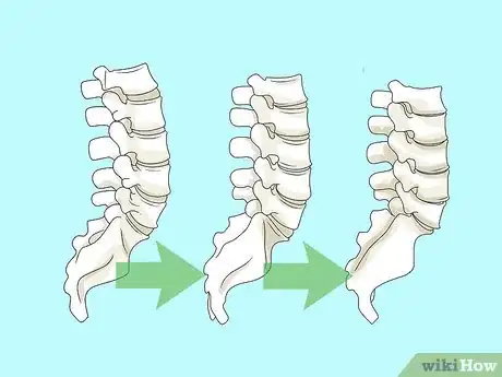 Image titled Study Pathology Step 4