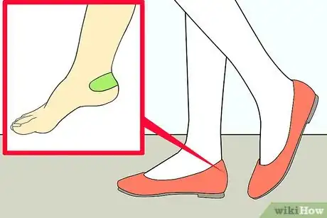 Image titled Make Ballet Flats Not Hurt Your Feet Step 9