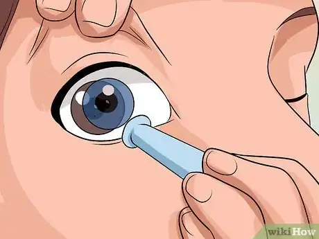 Image titled Remove Stuck Contact Lenses Step 13