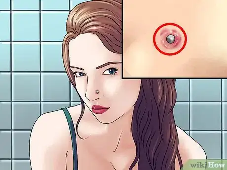 Image titled Care for Your Nose Piercing Step 13