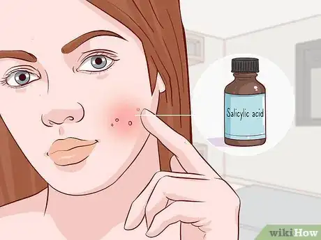 Image titled Treat Oily Skin with Large Pores Step 13