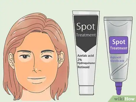 Image titled Get Rid of Dark Spots Step 2