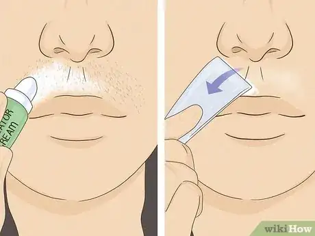 Image titled Get Rid of Female Facial Hair Step 4