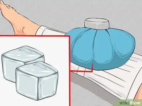 Image titled Apply First Aid without Bandages Step 21