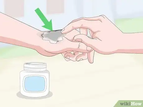 Image titled Remove Tar From Skin Step 11