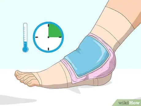 Image titled Wrap an Ankle with an ACE Bandage Step 15