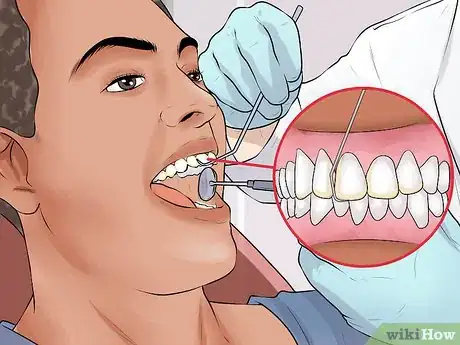 Image titled File Down Dentures Step 8