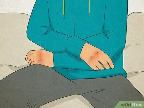 Image titled Stop Self Harming Step 10