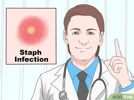 Image titled Recognize Staph Infection Symptoms Step 6