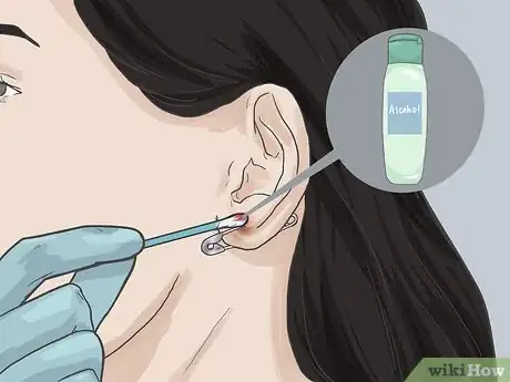 Image titled Pierce Your Ear with a Safety Pin Step 9