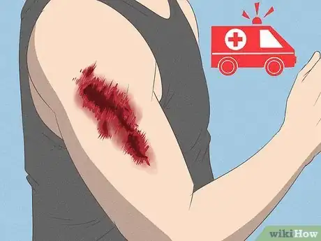 Image titled Clean Road Rash Step 2