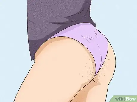 Image titled Get Rid of Acne on the Buttocks Step 2