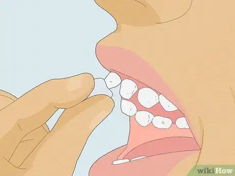 Image titled Pull a Loose Tooth at Home Step 3