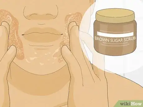 Image titled Get Rid of Peeling Skin Step 10