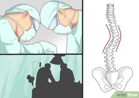 Image titled Relieve Back Pain from Scoliosis Step 12