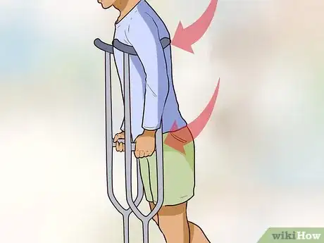 Image titled Use Crutches Step 3